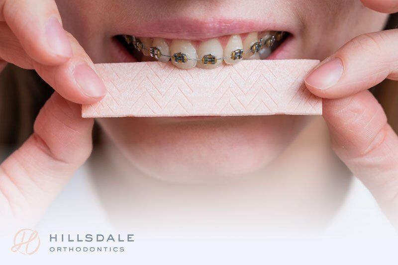 can you chew tobacco with braces Smoke or Vape Braces? Bad Habits to Avoid with